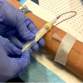 Extra 20G needles for transferring blood from tubes to PRP device