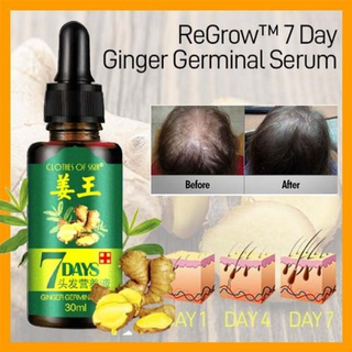 7 Day Ginger Germinal Oil Hair Nutrient Solution Hair Growth - Thumbnail 3
