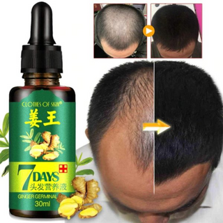 7 Day Ginger Germinal Oil Hair Nutrient Solution Hair Growth - Thumbnail 2