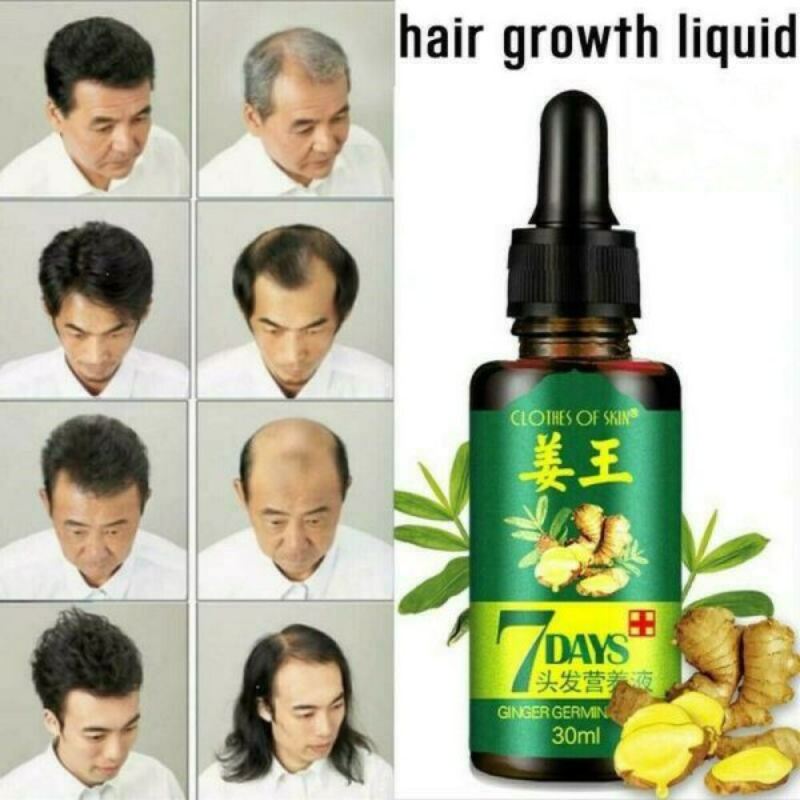 7 Day Ginger Germinal Oil Hair Nutrient Solution Hair Growth Large Image
