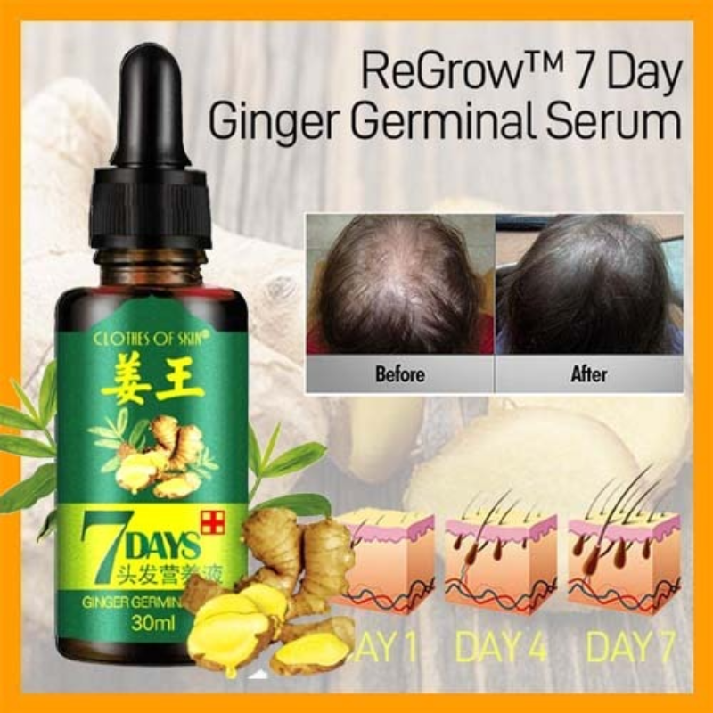 7 Day Ginger Germinal Oil Hair Nutrient Solution Hair Growth - Thumbnail (Preview) 3