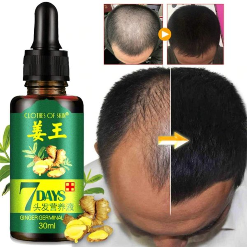 7 Day Ginger Germinal Oil Hair Nutrient Solution Hair Growth - Thumbnail (Preview) 2