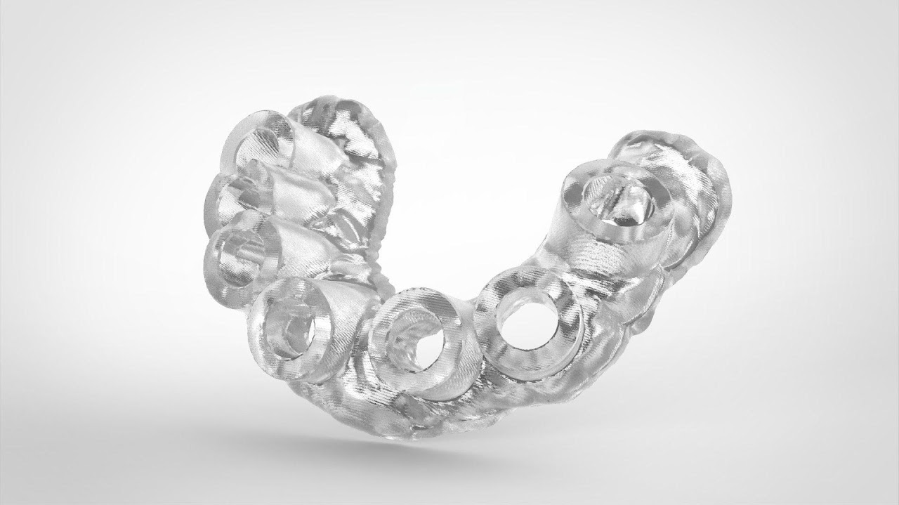 Full Mouth Dental Implants